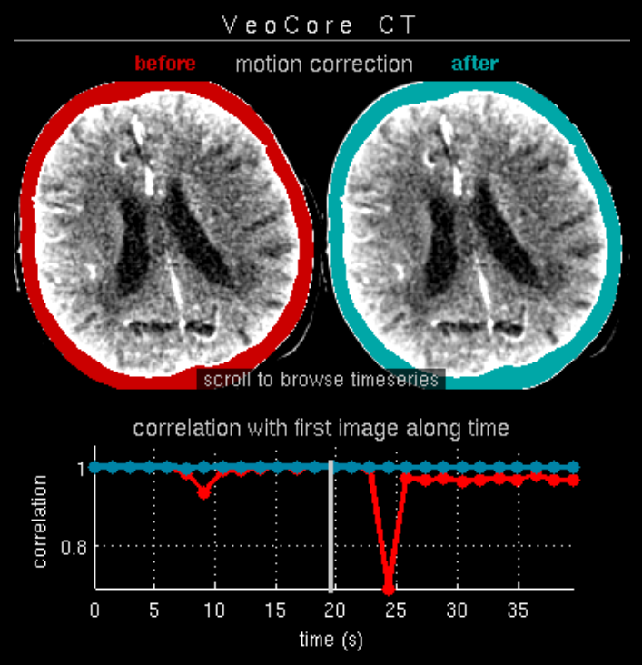 veocore motion correction