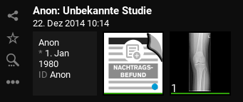 supplementary report approved