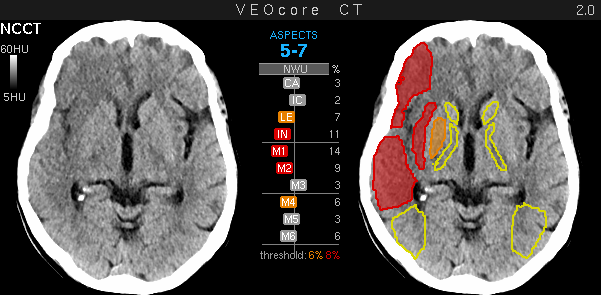 veoaspects report
