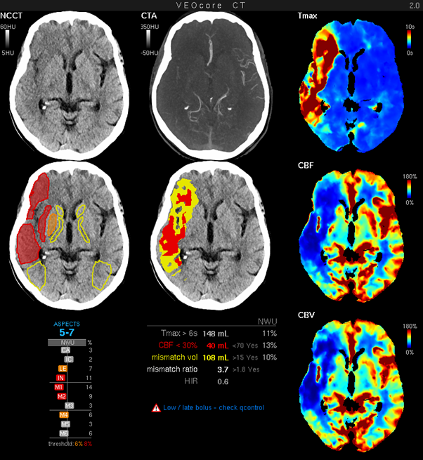 veoaspects multiview